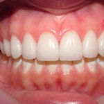 Agnes Big Bay Dental Barrie