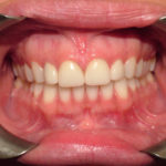 Jennifer Big Bay Dental Barrie