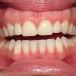 Jennifer Big Bay Dental Barrie